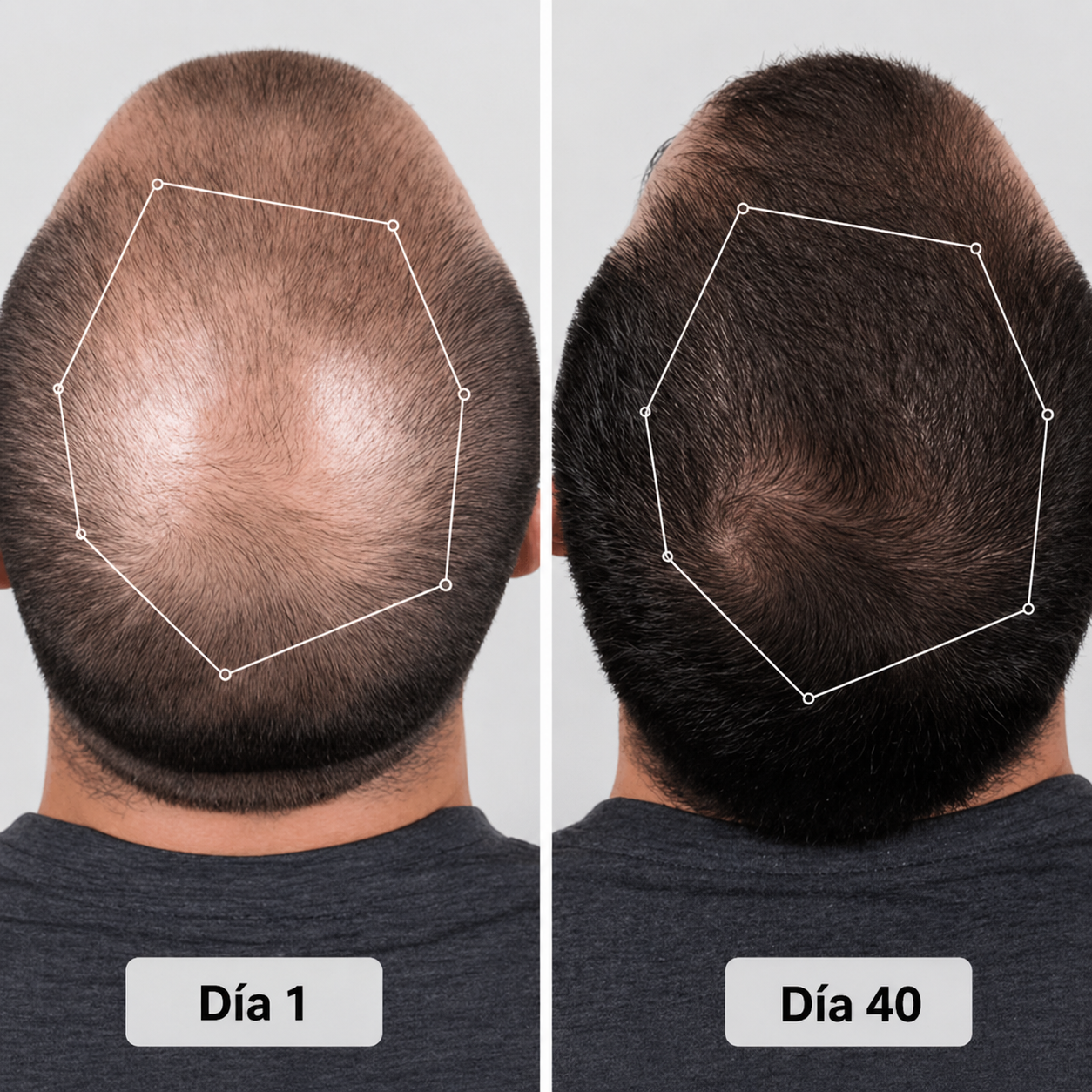 Novacap