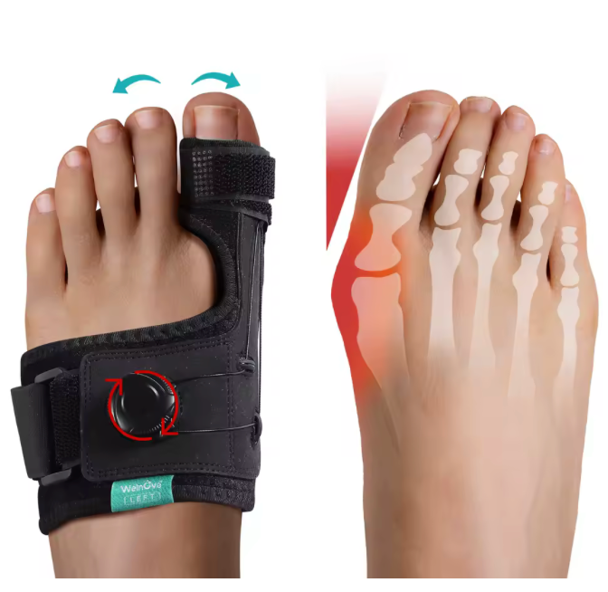 Bunion Corrector